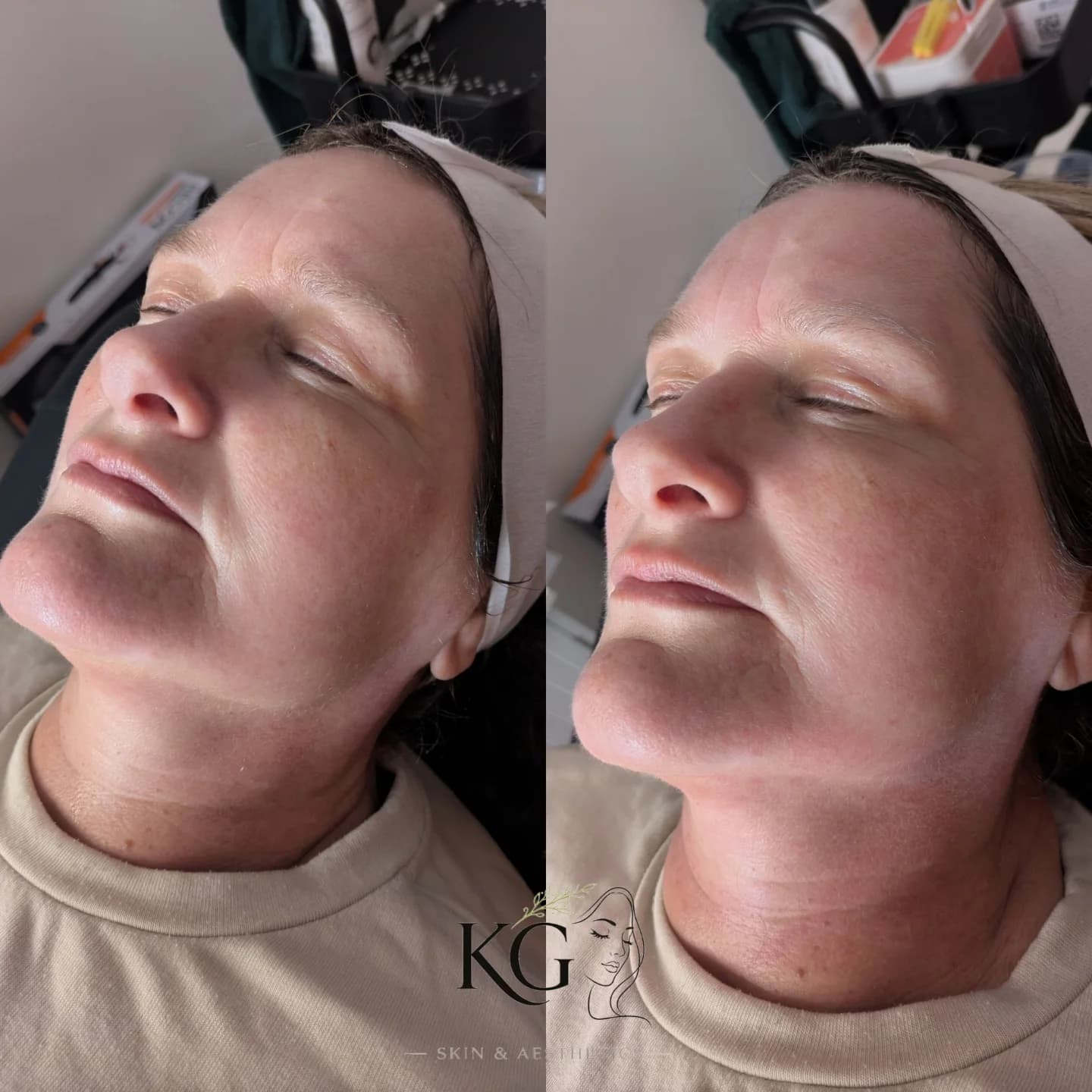 KG Skin Aesthetics result 1