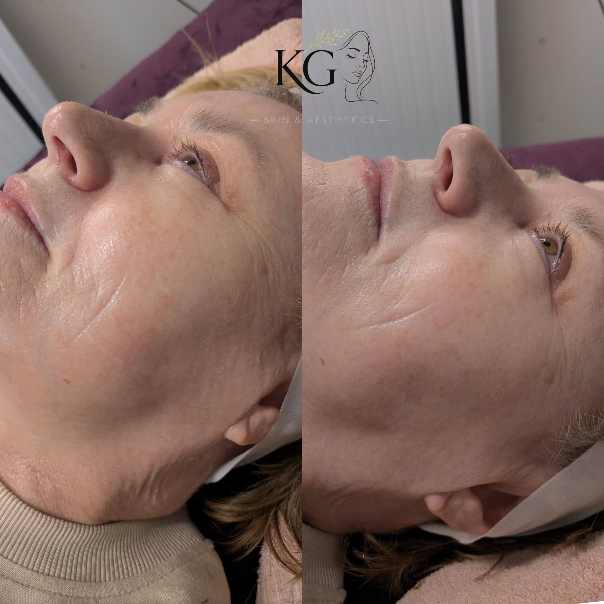 KG Skin Aesthetics result 2