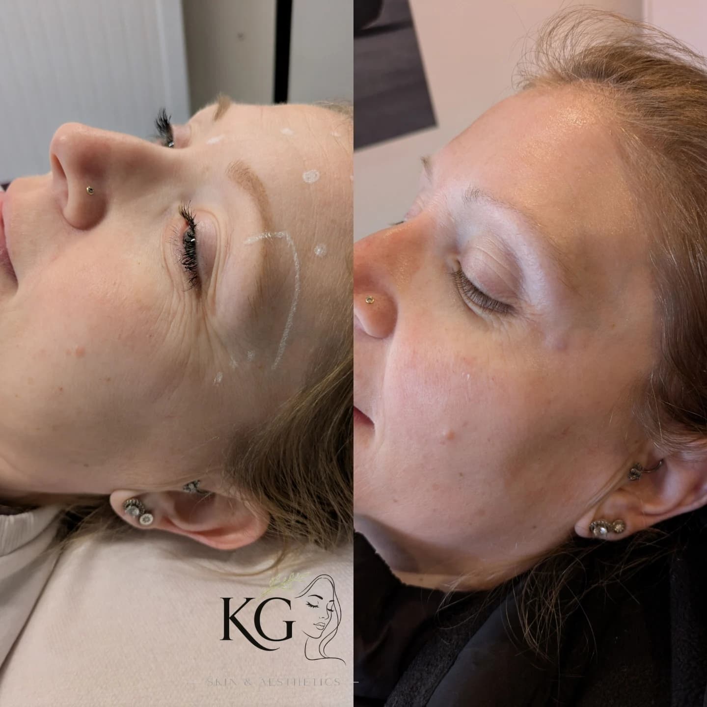 KG Skin Aesthetics result 3