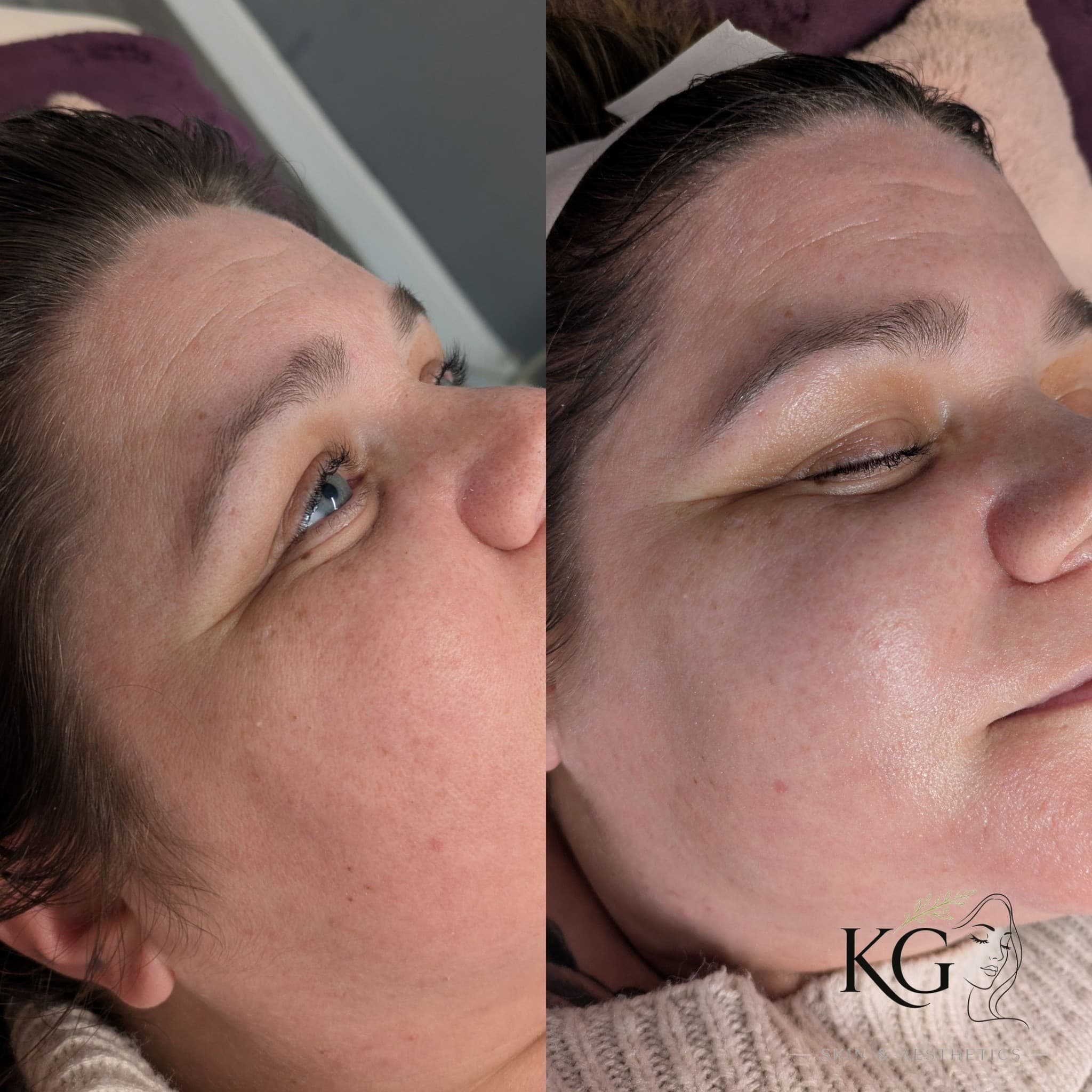 KG Skin Aesthetics result 4